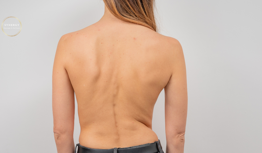 Unlocking Spinal Balance: Scoliosis
